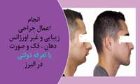 خبر خوب / انجام اعمال زیبایی و غیر اورژانسی جراحی فک و صورت با تعرفه دولتی در استان البرز